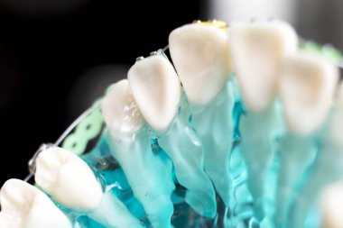 Diş metal diş teli Ortodonti modeli öğretim diş telini aligners.