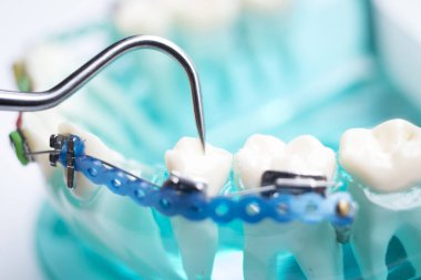 Diş metal diş teli Ortodonti modeli öğretim diş telini aligners.