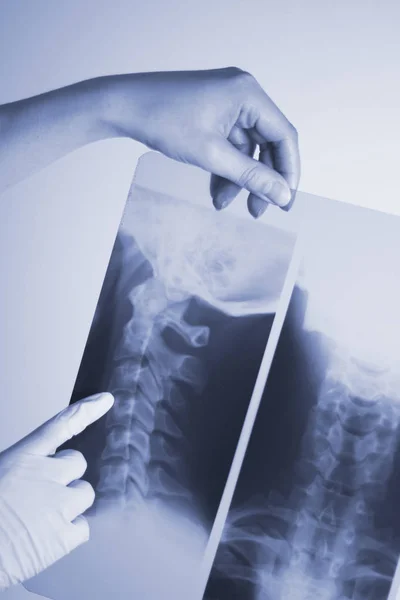 Рентгенологическое Сканирование Позвоночника Шеи — стоковое фото
