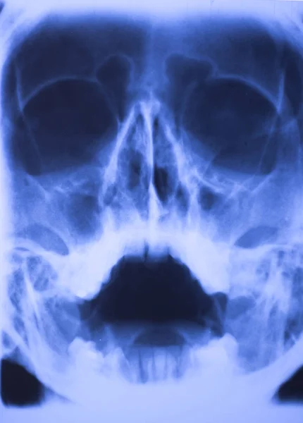 Hospital Médico Radiografia Rosto Crânio Boca Dentes Nariz Olhos Varredura — Fotografia de Stock