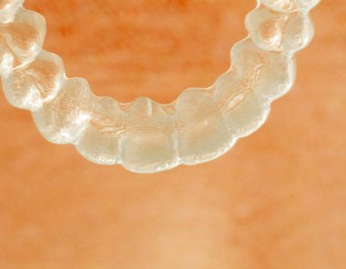 Görünmez açık diş diş aligner düzleştiriciler modern estetik parantez olarak ortodontik diş tedavisi için.