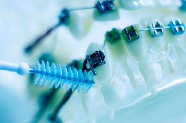 Diş diş fırçası sağlıklı ipi eylem her diş diş teli aligners ile arasında temizlik Inter.