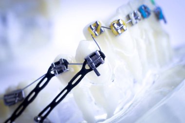 Diş metal diş teli Ortodonti modeli öğretim diş telini aligners.