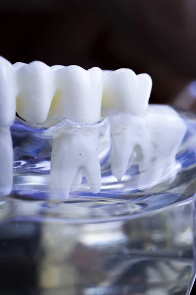 Dentista Modelo Enseñanza Dientes Dentales Que Muestra Cada Diente Encía —  Fotos de Stock