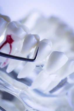 Titanyum metal diş hekimi temizlik dişler plak ve çürüme kaldırmak için araç almak.