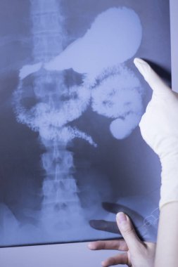 Tıbbi hastane röntgen lowe geri ağrı da mide ve organları gösteren omurga ve kalça Travmatoloji tarama.