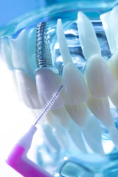 Inter Czyszczenie Pędzla Zdrowe Floss Działań Między Każdego Zęba Usunięcia — Zdjęcie stockowe