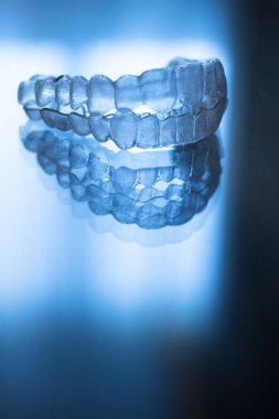 Görünmez açık diş diş aligner düzleştiriciler modern estetik parantez olarak ortodontik diş tedavisi için.