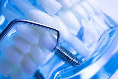 Titanyum metal diş hekimi temizlik dişler plak ve çürüme kaldırmak için araç almak.