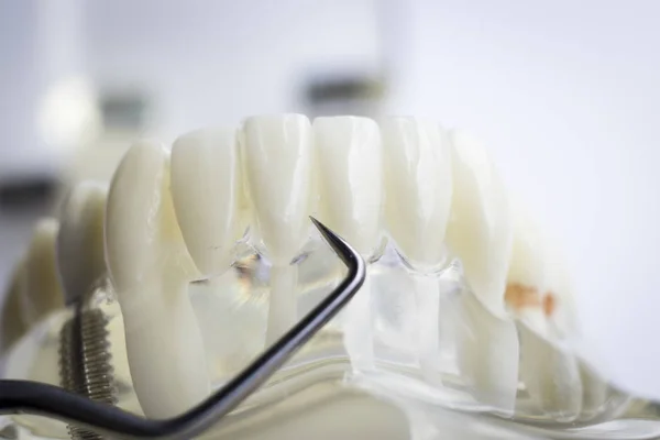 Zahnarzt Reinigung Der Zähne Mit Titan Metall Zahn Picking Instrument — Stockfoto