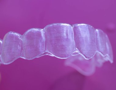 Görünmez açık diş diş aligner düzleştiriciler modern estetik parantez olarak ortodontik diş tedavisi için.