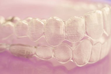 Görünmez açık diş diş aligner düzleştiriciler modern estetik parantez olarak ortodontik diş tedavisi için.