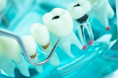 Titanyum metal diş hekimi temizlik dişler plak ve çürüme kaldırmak için araç almak.