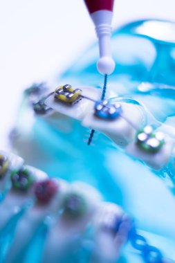 Diş diş fırçası sağlıklı ipi eylem her diş diş teli aligners ile arasında temizlik Inter.