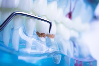 Titanyum metal diş hekimi temizlik dişler plak ve çürüme kaldırmak için araç almak.