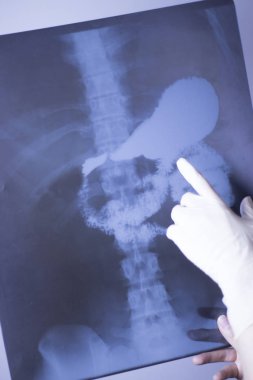 Tıbbi hastane röntgen lowe geri ağrı da mide ve organları gösteren omurga ve kalça Travmatoloji tarama.