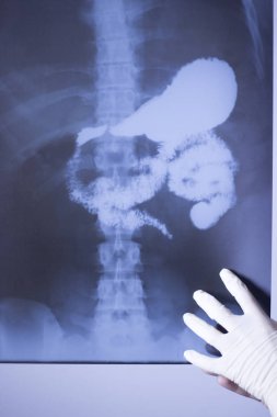 Tıbbi hastane röntgen lowe geri ağrı da mide ve organları gösteren omurga ve kalça Travmatoloji tarama.