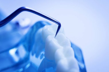 Titanyum metal diş hekimi temizlik dişler plak ve çürüme kaldırmak için araç almak.