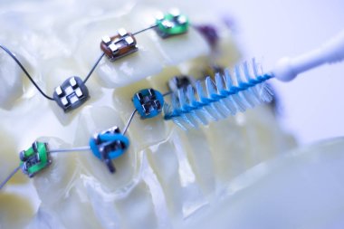 Diş diş fırçası sağlıklı ipi eylem her diş diş teli aligners ile arasında temizlik Inter.