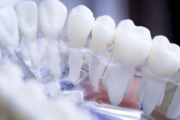 Denti Dentisti Modello Insegnamento Che Mostra Ogni Dente Gomma Pazienti — Foto Stock