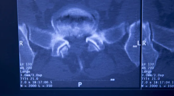 Медична Лікарня Рентгенівські Стегна Хребетного Таза Мрт Травматологія Сканування — стокове фото