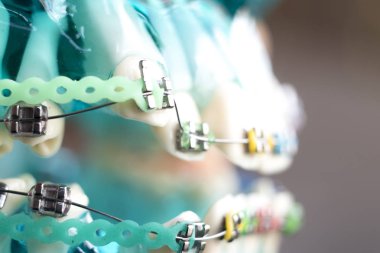 Diş metal diş teli Ortodonti modeli öğretim diş telini aligners.