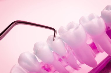 Titanyum metal diş hekimi temizlik dişler plak ve çürüme kaldırmak için araç almak.