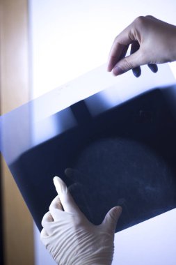 Tıbbi hastane mamografi x-ray meme kanseri mamografi inceden inceye gözden geçirmek.