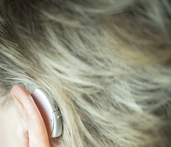 Gehörlose Dame Mit Moderner Technik Digitales Hörgerät Ohr — Stockfoto