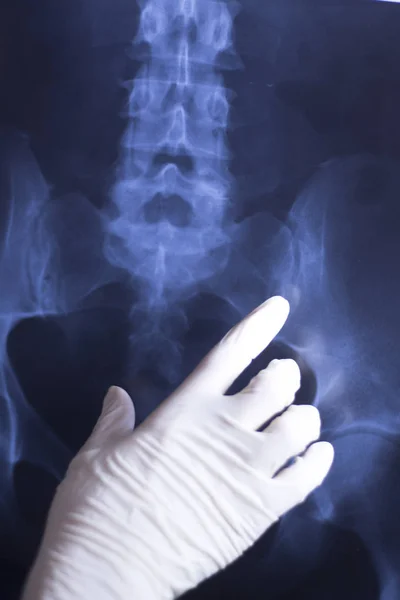 医療病院 ロウ背中の痛み背骨と腰外傷スキャン — ストック写真