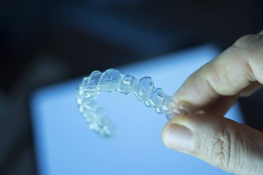 Kozmetik diş hekimliğinde hastalar için dişleri hizalamak için kullanılan görünmez diş düzenleyiciler.