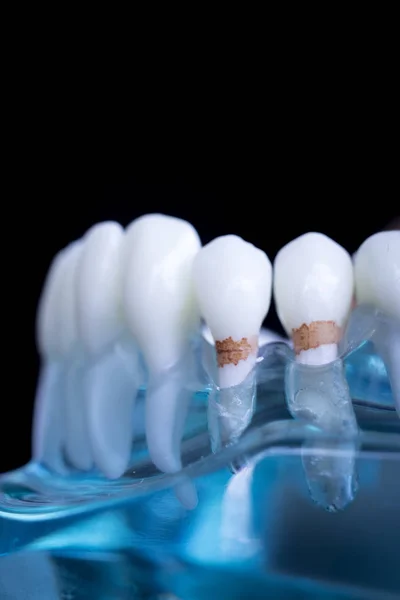 Dentista Modelo Enseñanza Dientes Dentales Que Muestra Cada Diente Encía —  Fotos de Stock