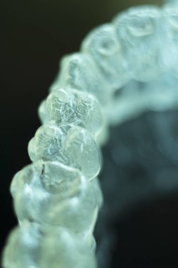 Kozmetik diş hekimliğinde hastalar için dişleri hizalamak için kullanılan görünmez diş düzenleyiciler.