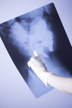 Tıbbi hastane röntgen lowe geri ağrı da mide ve organları gösteren omurga ve kalça Travmatoloji tarama.