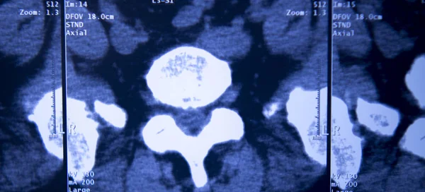 Radiografia Hospitalar Médica Quadris Coluna Pélvis Ressonância Magnética Traumatologia — Fotografia de Stock