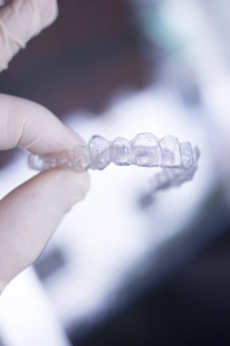 Kozmetik diş hekimliğinde hastalar için dişleri hizalamak için kullanılan görünmez diş düzenleyiciler.