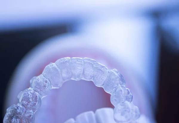 Allineatori Dentali Invisibili Staffe Utilizzate Allineare Ogni Dente Odontoiatria Estetica — Foto Stock
