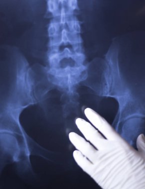 Tıbbi hastane röntgen lowe sırt ağrısı omurga ve kalça Travmatoloji tarama.