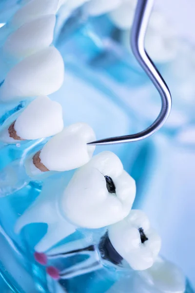 Dentista Limpieza Dientes Con Instrumento Selección Dientes Metal Titanio Para — Foto de Stock