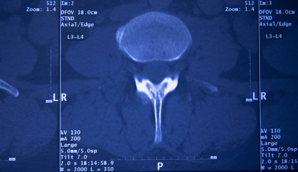 Медична Лікарня Рентгенівські Стегна Хребетного Таза Мрт Травматологія Сканування — стокове фото