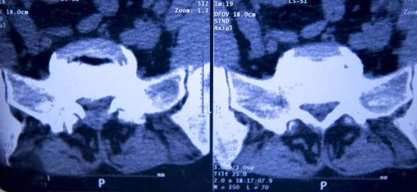 Медична Лікарня Рентгенівські Стегна Хребетного Таза Мрт Травматологія Сканування — стокове фото