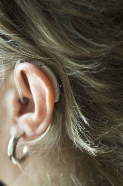 Kulaklarında işitme cihazı varken sağır kadın