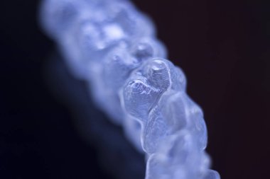 Görünmez diş diş aligners