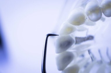 Titanyum metal diş hekimi temizlik dişler plak ve çürüme kaldırmak için araç almak.