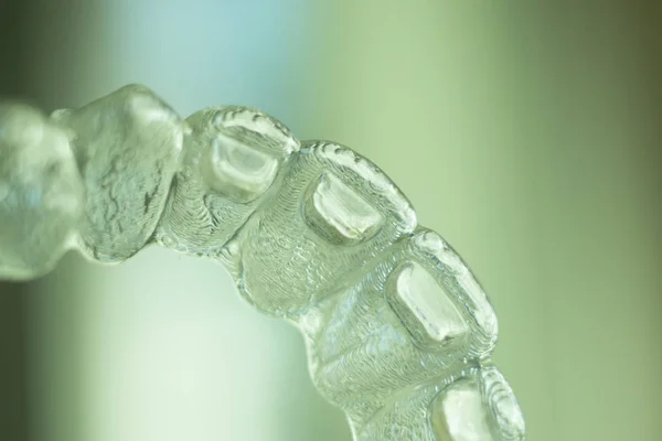 Niewidoczne Ząbki Dentystyczne Wsporniki Stosowane Wyrównania Każdego Zęba Stomatologii Kosmetycznej — Zdjęcie stockowe