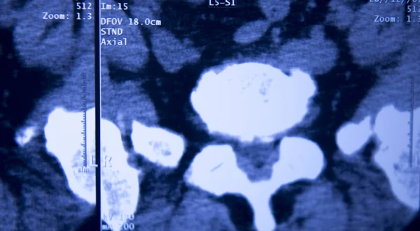 Медична Лікарня Рентгенівські Стегна Хребетного Таза Мрт Травматологія Сканування — стокове фото