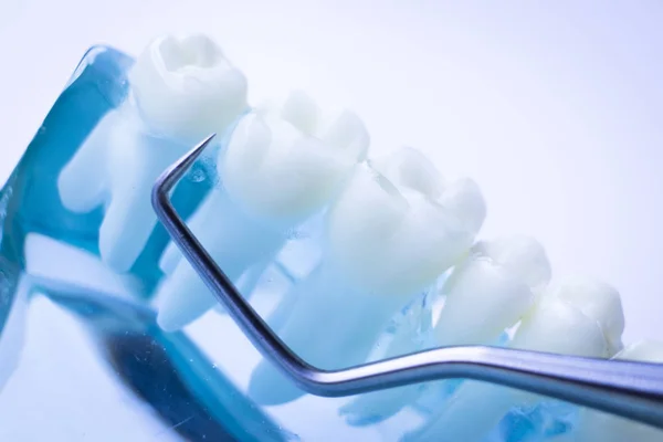 Dentista Limpieza Dientes Con Instrumento Selección Dientes Metal Titanio Para — Foto de Stock