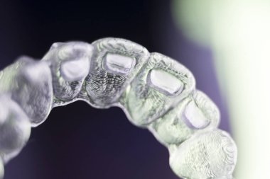 Kozmetik diş hekimliğinde hastalar için dişleri hizalamak için kullanılan görünmez diş düzenleyiciler.