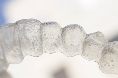 Görünmez plastik dirsek diş diş aligner ortodontik düzleştiriciler.