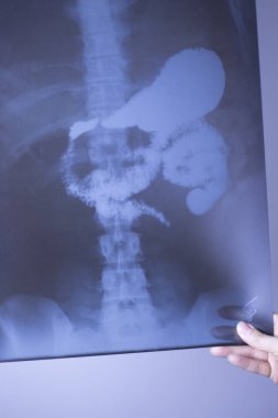 Tıbbi hastane röntgen lowe geri ağrı da mide ve organları gösteren omurga ve kalça Travmatoloji tarama.